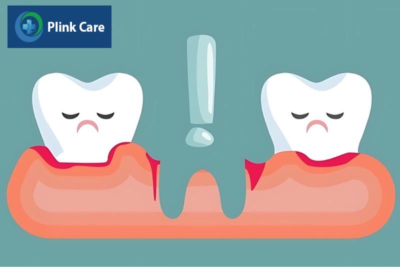 những biến chứng sau khi nhổ răng, Chảy máu sau khi nhổ răng