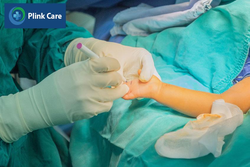 ca phẫu thuật cần được thực hiện bởi bác sĩ có chuyên môn