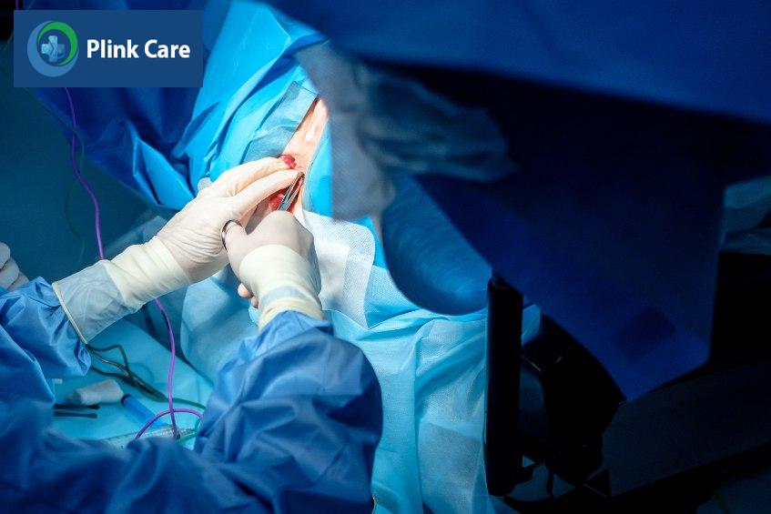 cắt polyp hậu môn có đau không