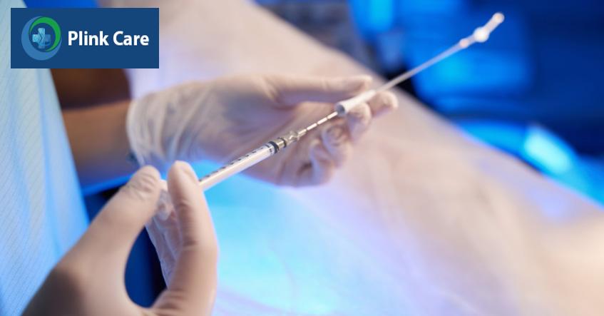 Catheter chuyên dụng thường dùng chuyển phôi vào tử cung