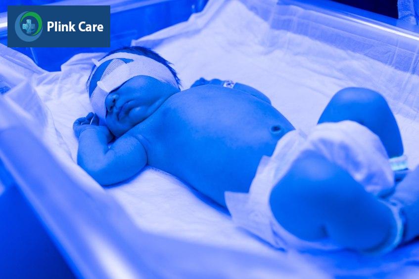 Chiếu đèn trị vàng da cho trẻ sơ sinh
