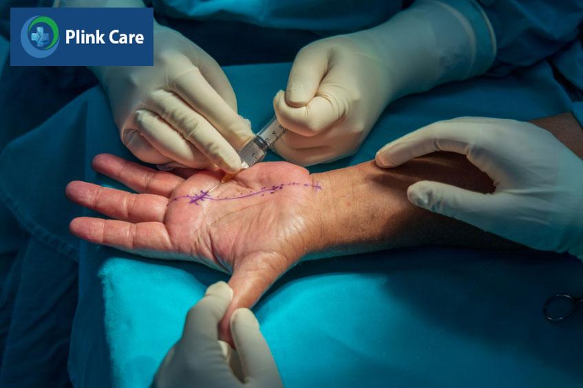 có thể cử động ngón tay khi gân gấp được giải phóng