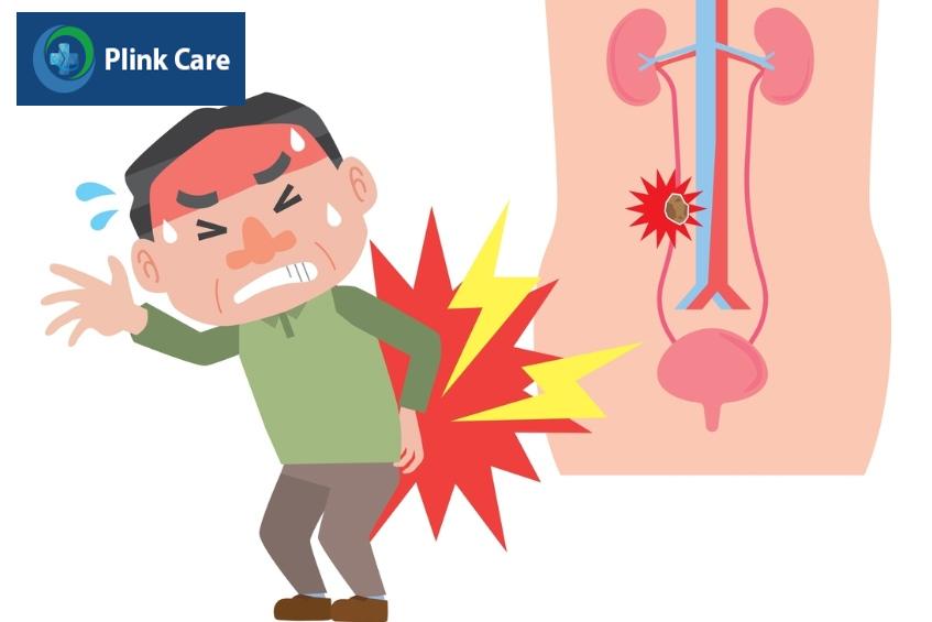 đau lưng đột ngột triệu chứng của sỏi tiết niệu