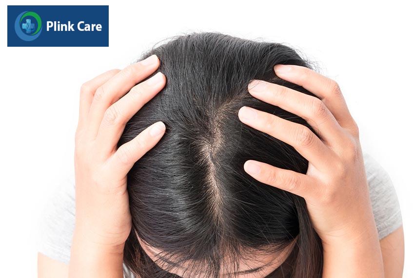 đột biến gen có thể là nguyên nhân mắc bệnh u sao bào lông