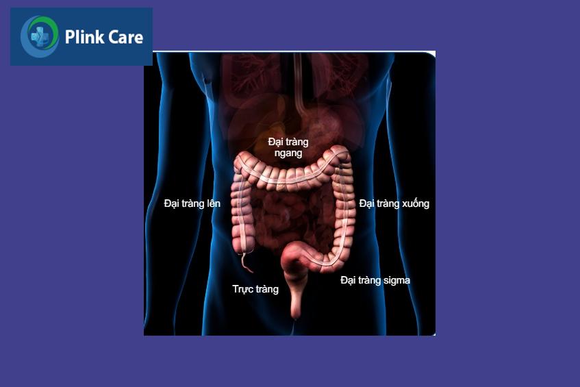 giải phẫu tầm soát ung thư đại trực tràng