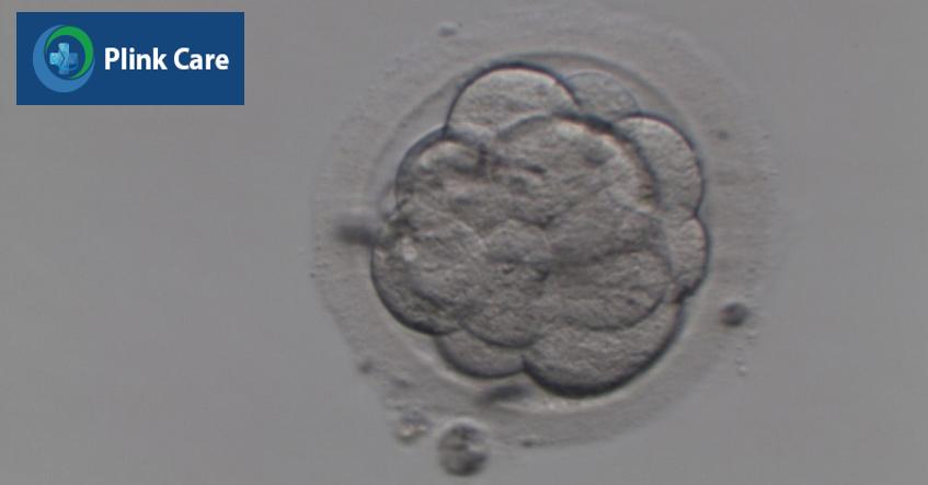 Hình ảnh một phôi ngày 3 tại IVF Tâm Anh