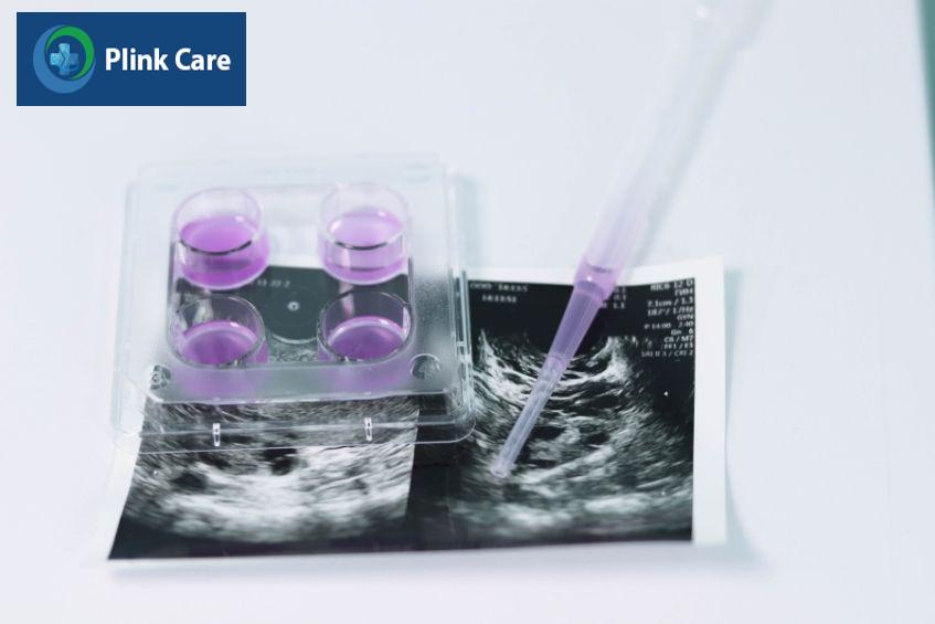 Không có sự khác biệt đáng kể ở tỷ lệ thành công của 2 phương pháp chuyển phôi tươi và chuyển phôi trữ