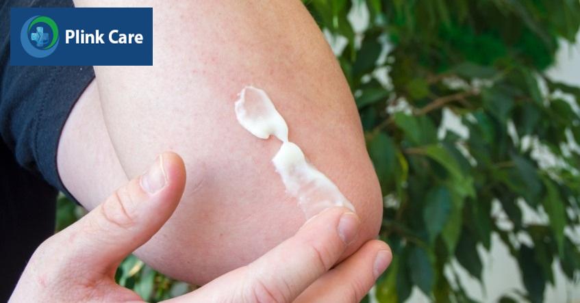 không tự ý tìm mua thuốc bôi kiến ba khoang