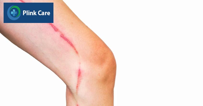 Ki¿n ba khoang c¯n có sao không - Thumb m«u 2 dòng tiêu Á: 1 lÛn ß trên + 1 nhÏ ß d°Ûi (5)