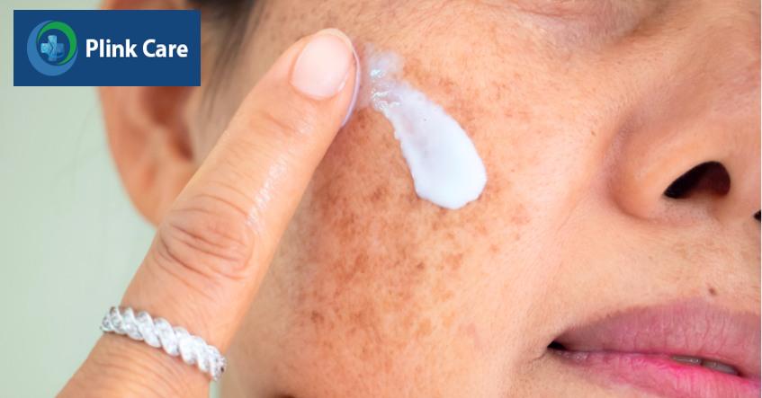 make up che đi nám mảng