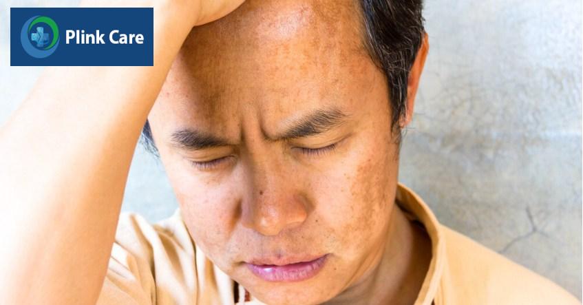 nam giới bị nám mảng