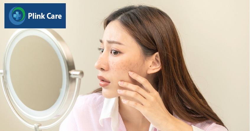 nám mảng ở má