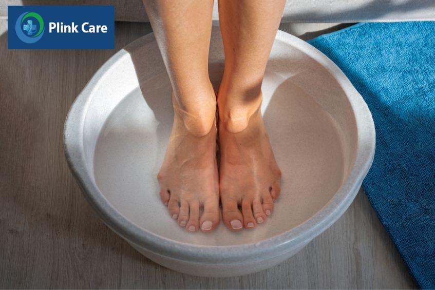 Ngân chân trị suy giãn tĩnh mạch tại nhà hiệu quả
