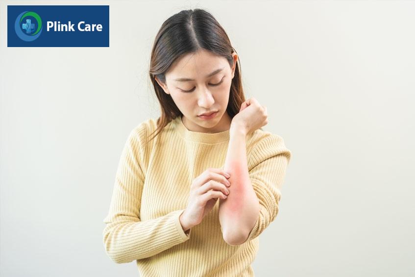 nhận biết cơ thể nổi mề đay