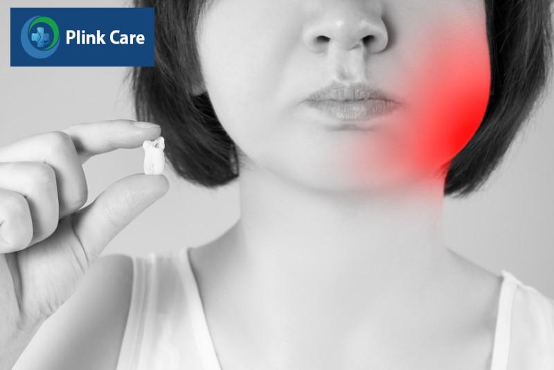 nhổ răng khôn có nguy hiểm, sưng tấy