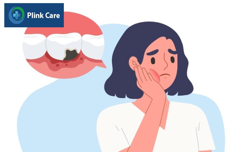 Khi nào phải nhổ răng vĩnh viễn?