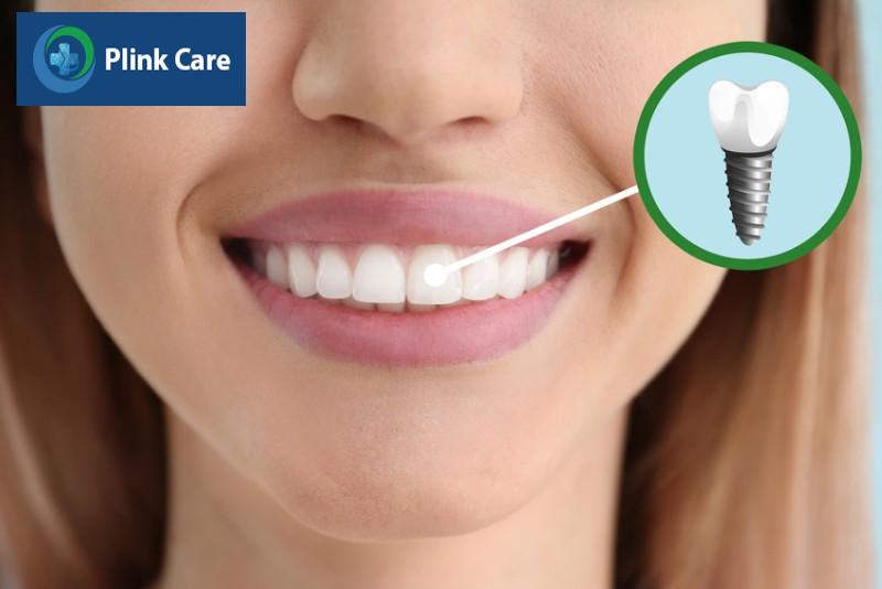 Giải pháp nào tối ưu sau khi nhổ răng vĩnh viễn?