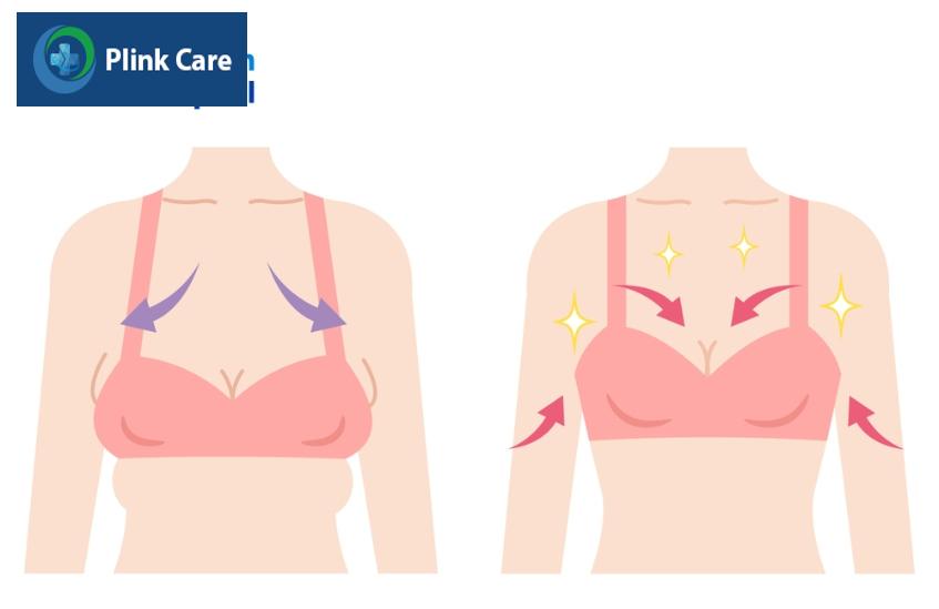 phẫu thuật chỉnh sửa túi độn ngực