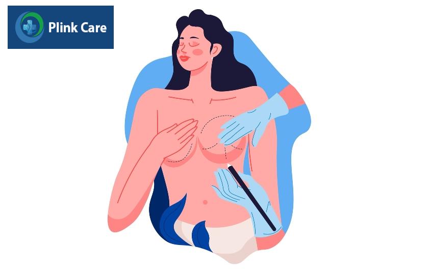 phẫu thuật hỗ trợ sau đặt túi ngực