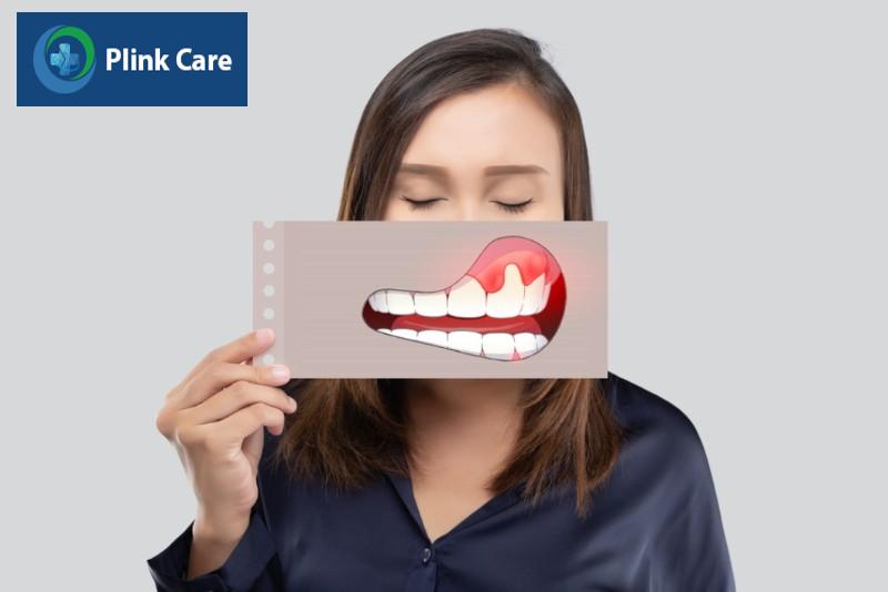 biến chứng nhổ răng, Nhiễm trùng sau nhổ răng