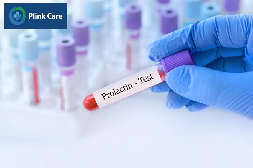 tăng prolactin máu là tình trạng dư thừa prolactin trong máu
