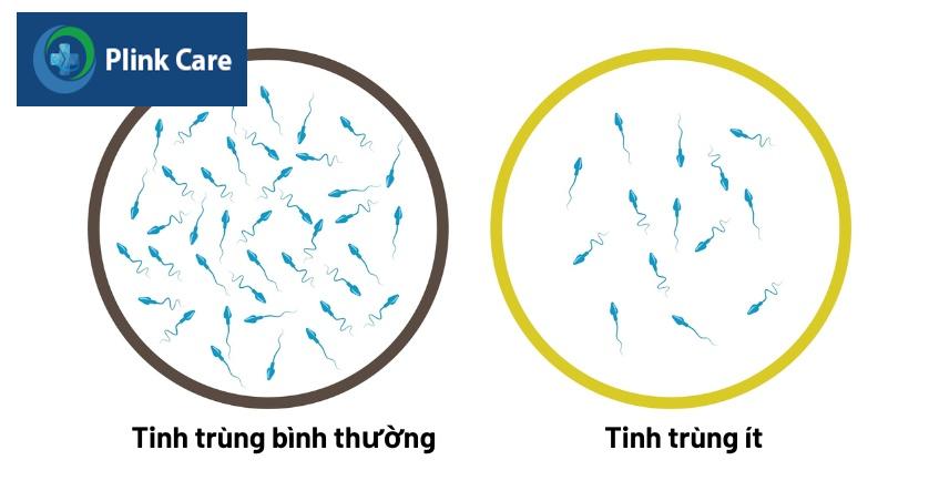 tinh trùng ít là gì