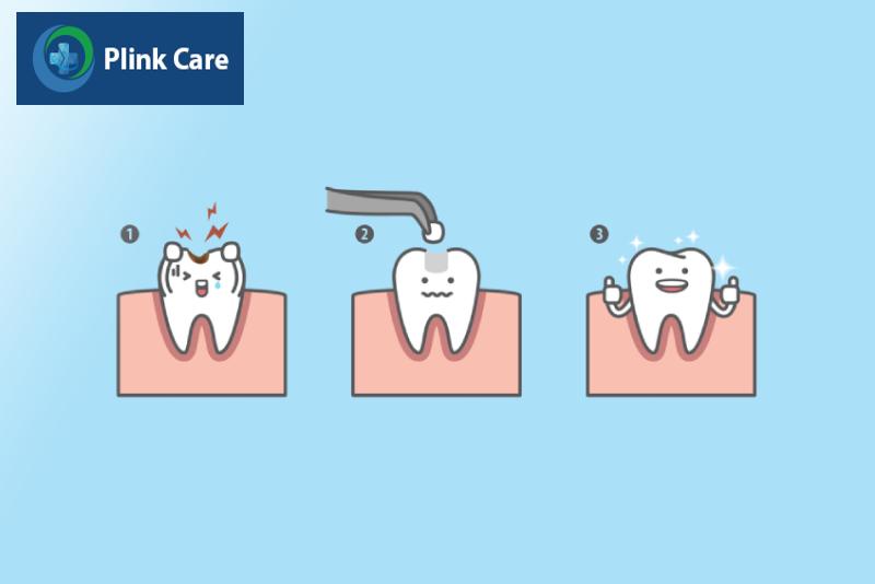 Quy trình trám răng bằng composite diễn ra thế nào?