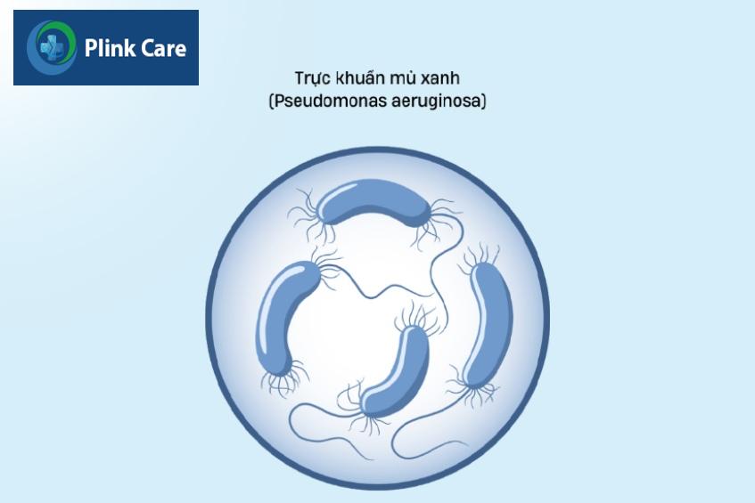trực khuẩn mủ xanh gây viêm ống tai