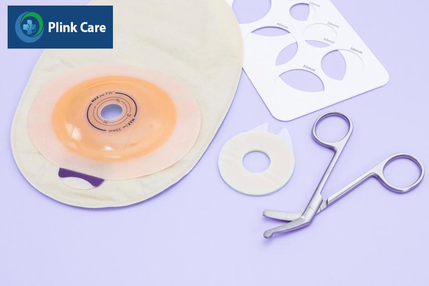 túi hậu môn nhân tạo điều trị k trực tràng