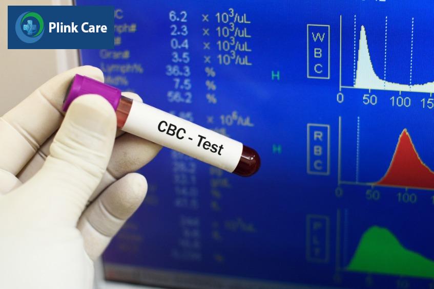 xét nghiệm chẩn đoán ung thư trực tràng giai đoạn 4