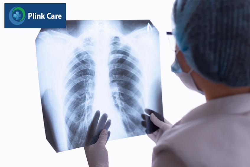 Bác sĩ kiểm tra tổng quan các chỉ số sinh tồn, kết hợp chẩn đoán hình ảnh để đánh giá nguy cơ ở các hệ cơ quan, nhất là tim mạch và hô hấp