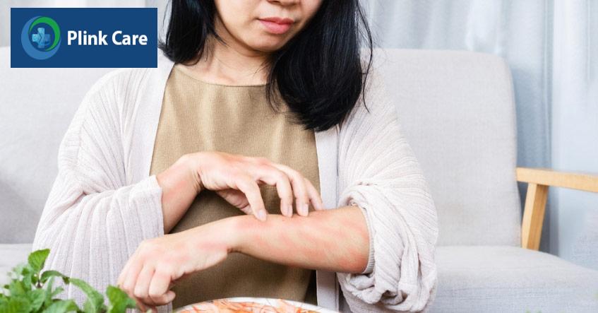 bị ngứa dữ dội do nổi mề đay liên tục