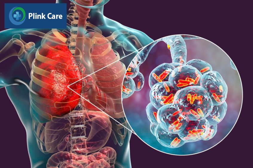 Bỏ các thói quen có hại để bảo vệ phổi khỏe mạnh