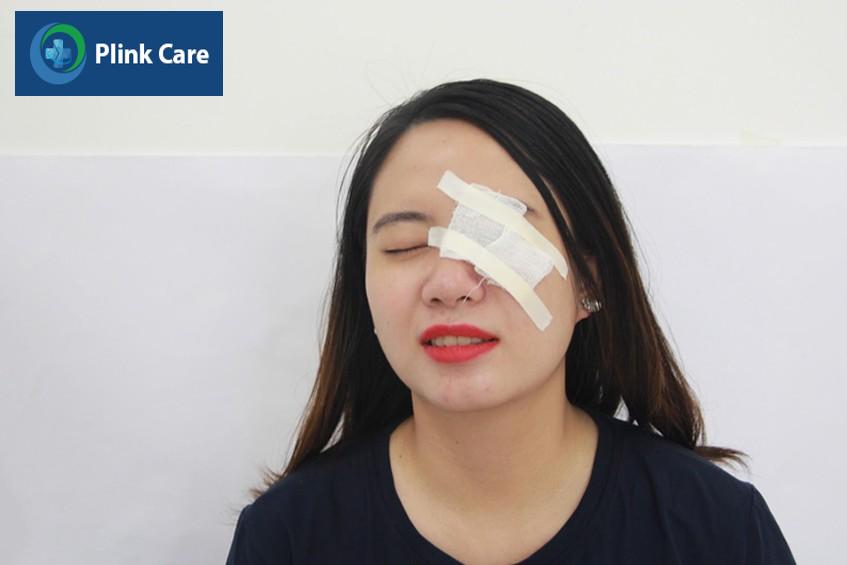 chấn thương mắt dễ bị glocom góc đóng