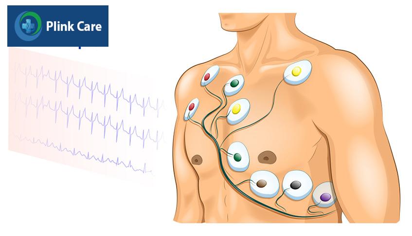 Điện tâm đồ đánh giá chức năng tim được thực hiện trong khám tiền mê
