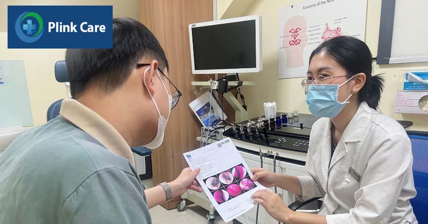 điều trị sổ mũi