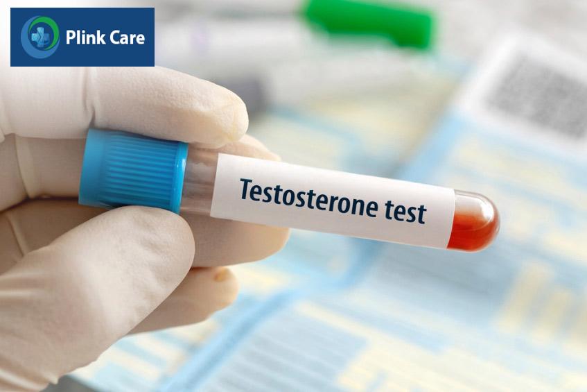 kiểm tra nồng độ testosterone thông qua xét nghiệm máu