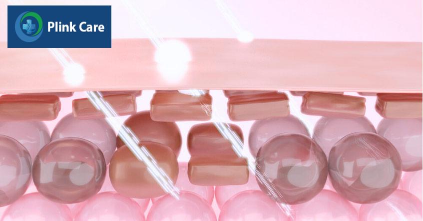 laser có thể tác động đến các tầng cấu trúc sâu trong da