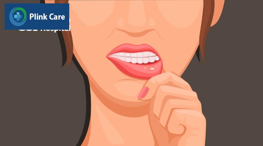 Loét miệng do hóa trị