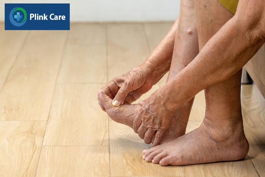 người bệnh tiểu đường tuýp 2 có thể bị biến chứng bàn chân