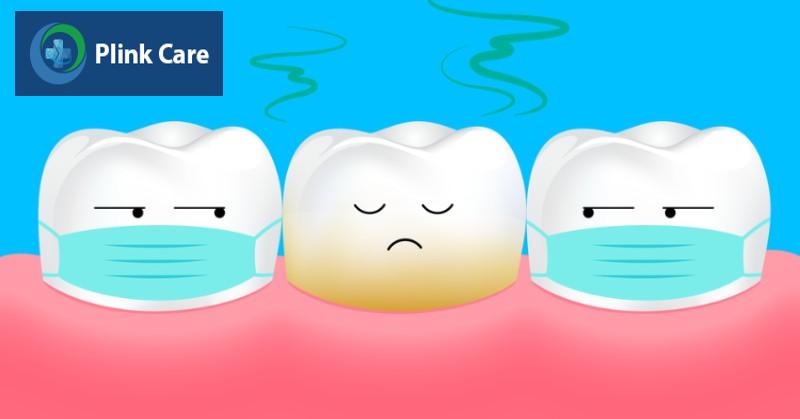 Nguyên nhân gây hôi miệng là gì? Mảng bám do vệ sinh kém