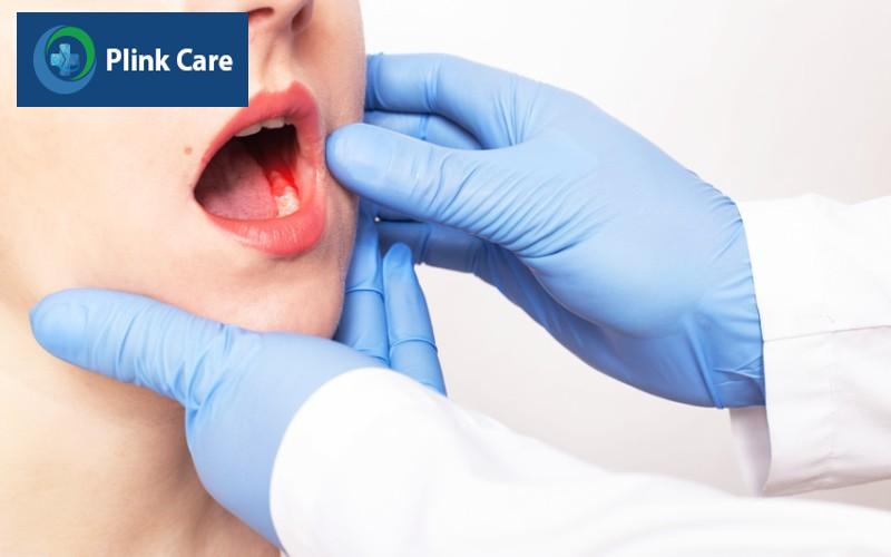 Đau răng kéo dài có thể gây hậu quả nào?