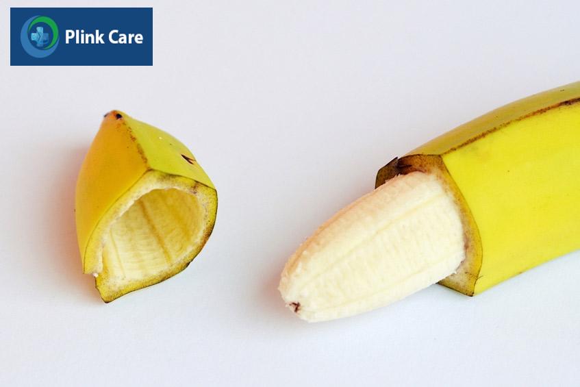 nong lỗ bao da hoặc cắt bao quy đầu để điều trị dính bao quy đầu ở trẻ