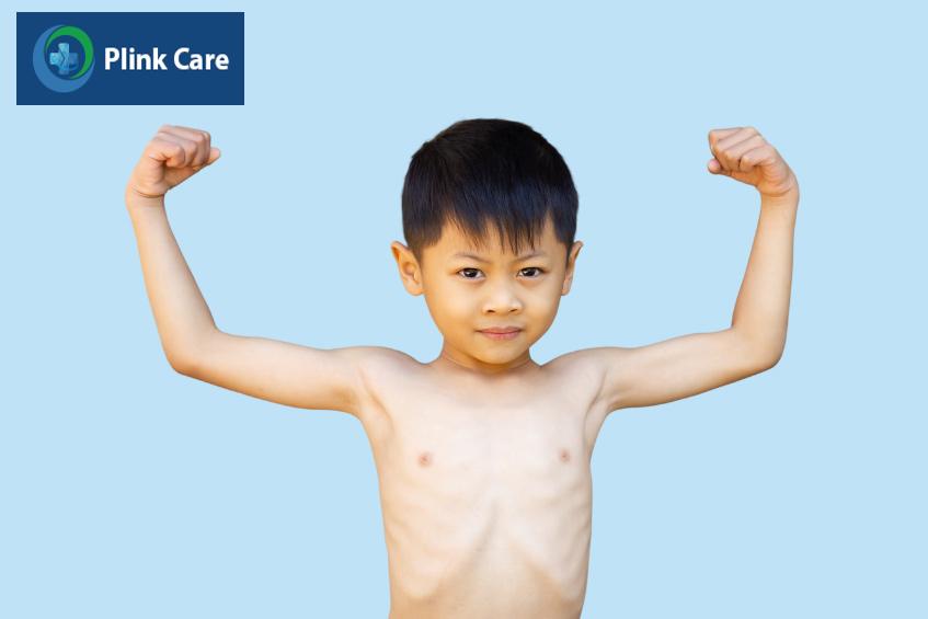 suy dinh dưỡng thể gầy còm là tình trạng trẻ ốm