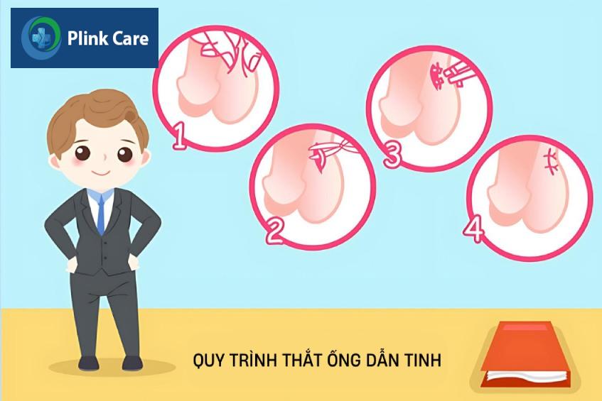 thắt ống dẫn tinh có an toàn không