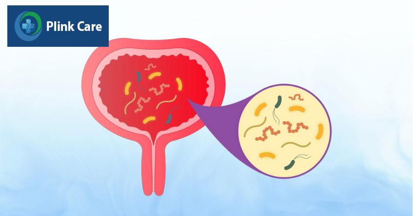 vi khuẩn là nguyên nhân hàng đầu gây viêm bàng quang ở trẻ em