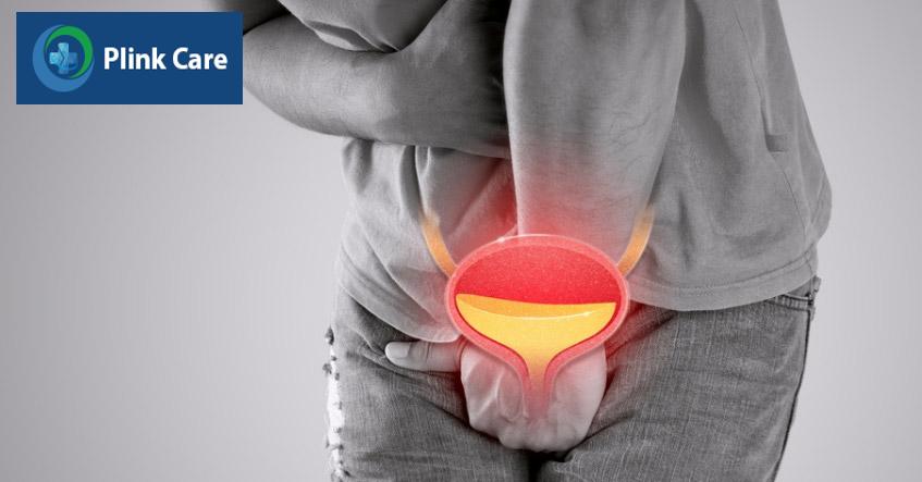 viêm bàng quang nặng không quan hệ trong quá trình điều trị
