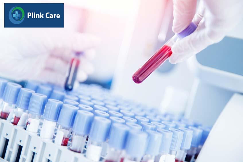 xét nghiệm máu giúp xác định mức độ tiến triển của bệnh