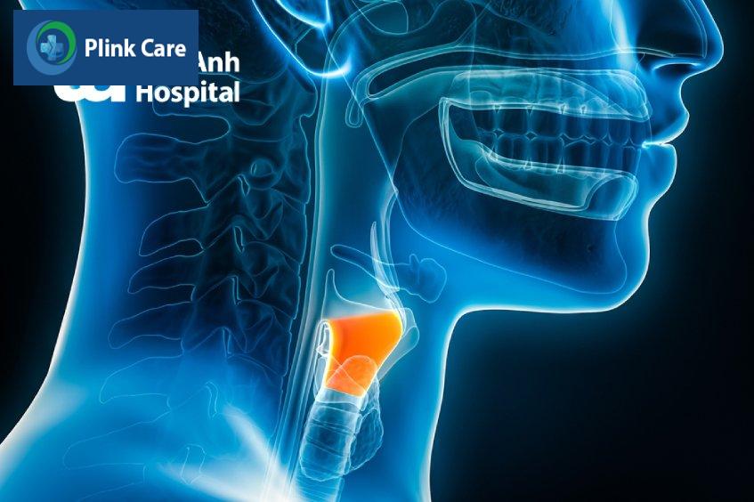 bệnh viêm thanh quản mãn tính