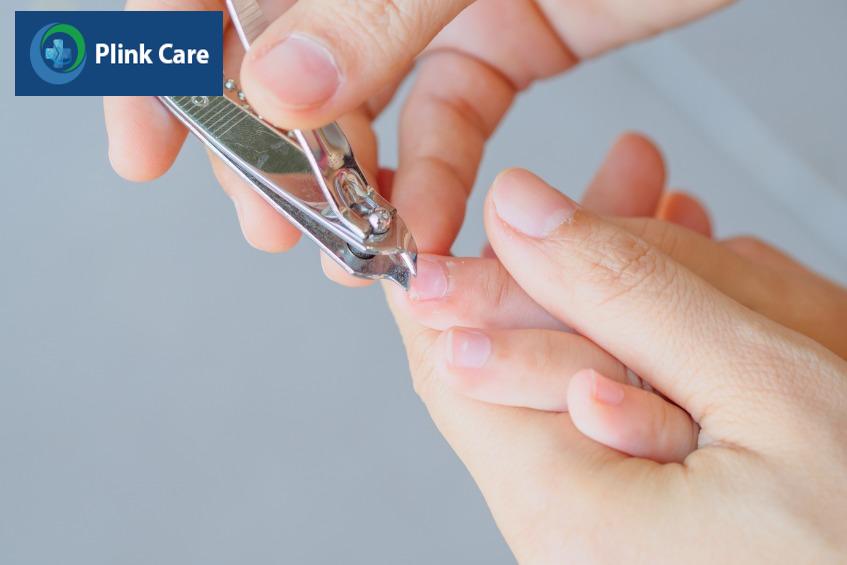 Cắt ngắn móng tay cho trẻ nhằm tránh để trẻ gãi